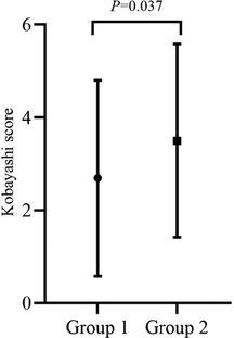 Kawasaki disease following SARS-CoV-2 infection: Stronger inflammation with no increase in cardiac complications